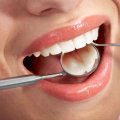 Understanding the Process of Getting a Dental Filling