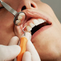 Understanding Indemnity Plans: Your Guide to Affordable Dental Insurance