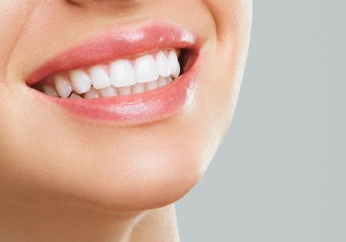 Different Methods for Whitening Teeth: A Comprehensive Guide