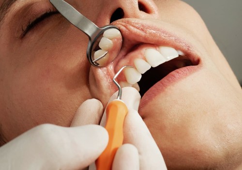 Understanding Indemnity Plans: Your Guide to Affordable Dental Insurance